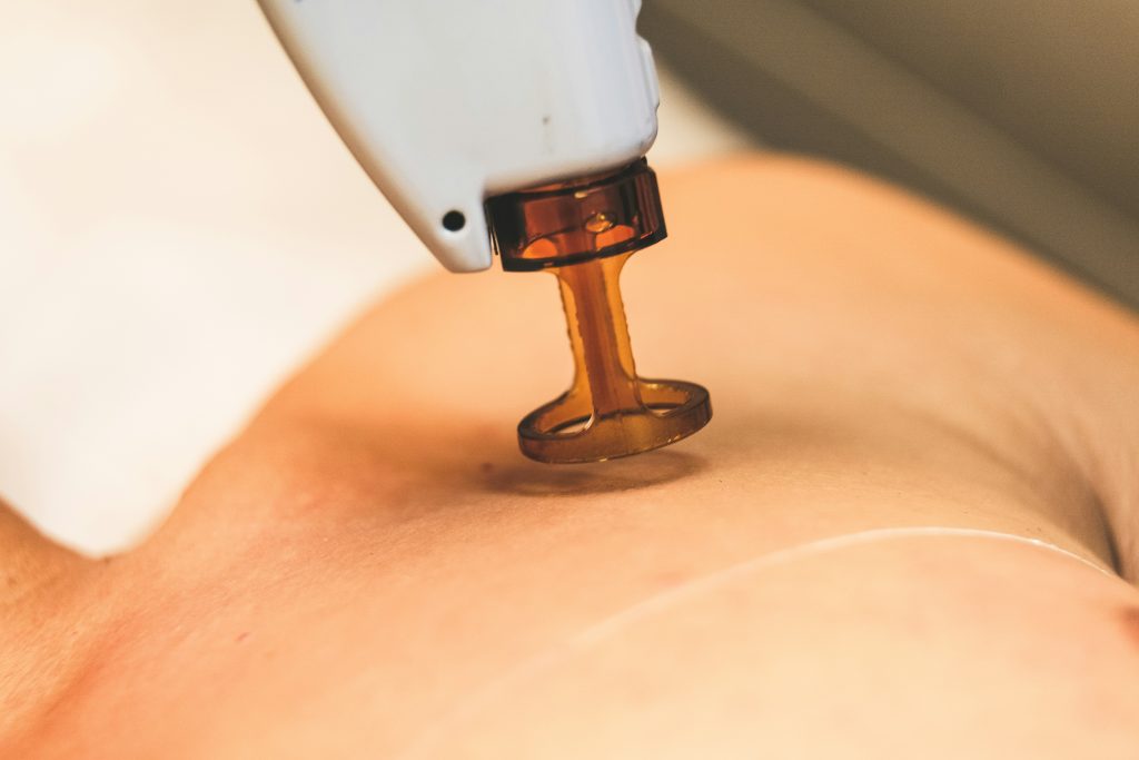 Close-up of a treatment wand applying a warm brown gel to a person’s skin during a spa or cosmetic procedure.