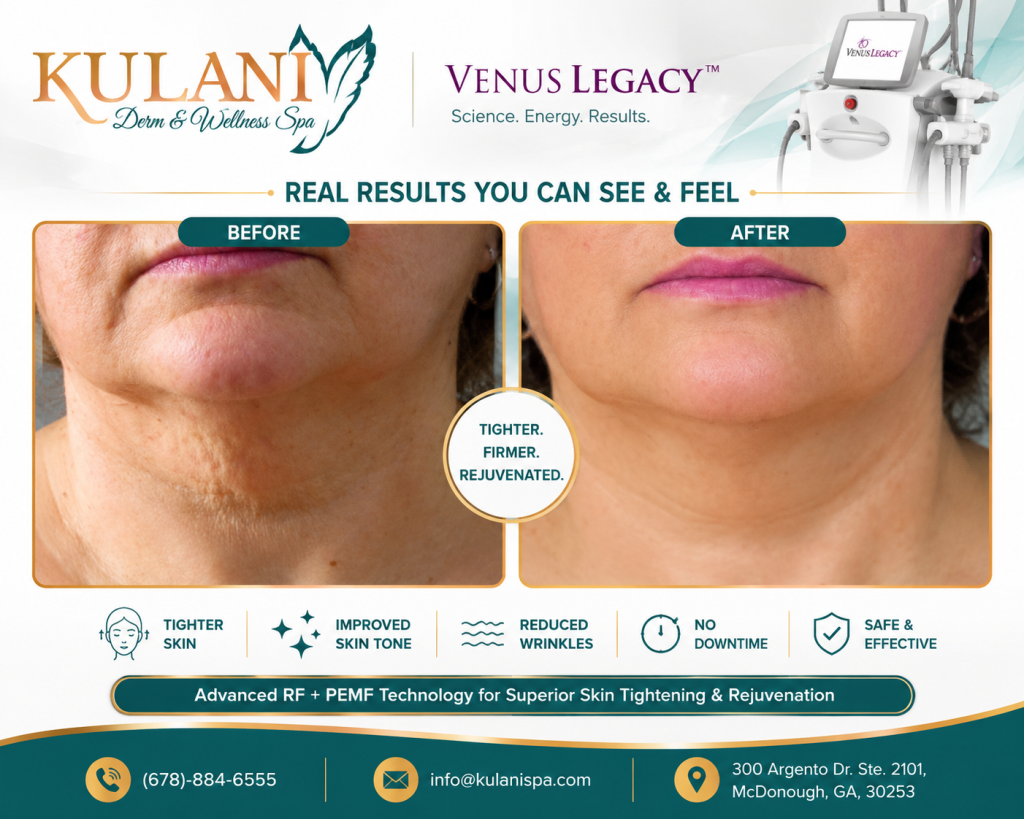 image - Kulani Spa Advertisement showing before/after neck tightening results for Kulani Derm & Wellness Spa; 'Before' and 'After' panels with a central circular badge 'Tighten. Firmer. Rejuvenated.' and the logos 'Kulani' and 'Venus Legacy' at the top.
