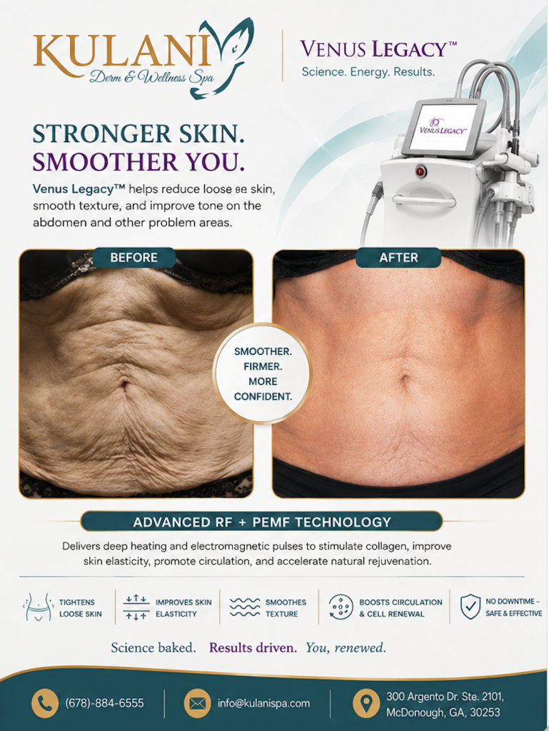 image - Kulani Spa Advertisement showing before and after abdominal treatment: loose skin on left, smoother skin on right, with Venus Legacy device nearby.