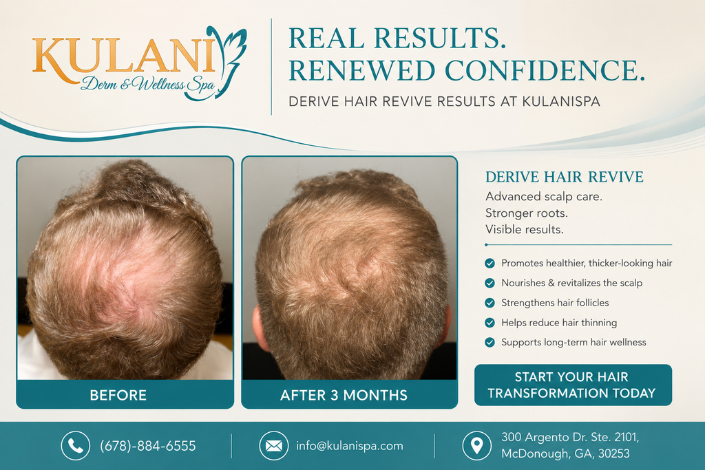 Before and after photos of the top of a man's head showing hair thickening after 3 months in a spa ad contrast frame (Before / After 3 Months).