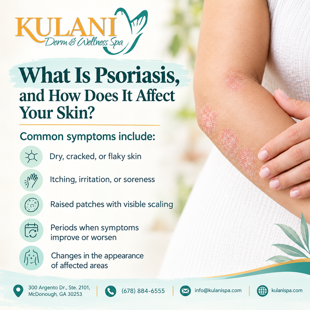 Kulani Derm & Wellness Spa infographic about psoriasis; left side lists symptoms, right shows an arm with psoriasis patches, logo at top left.